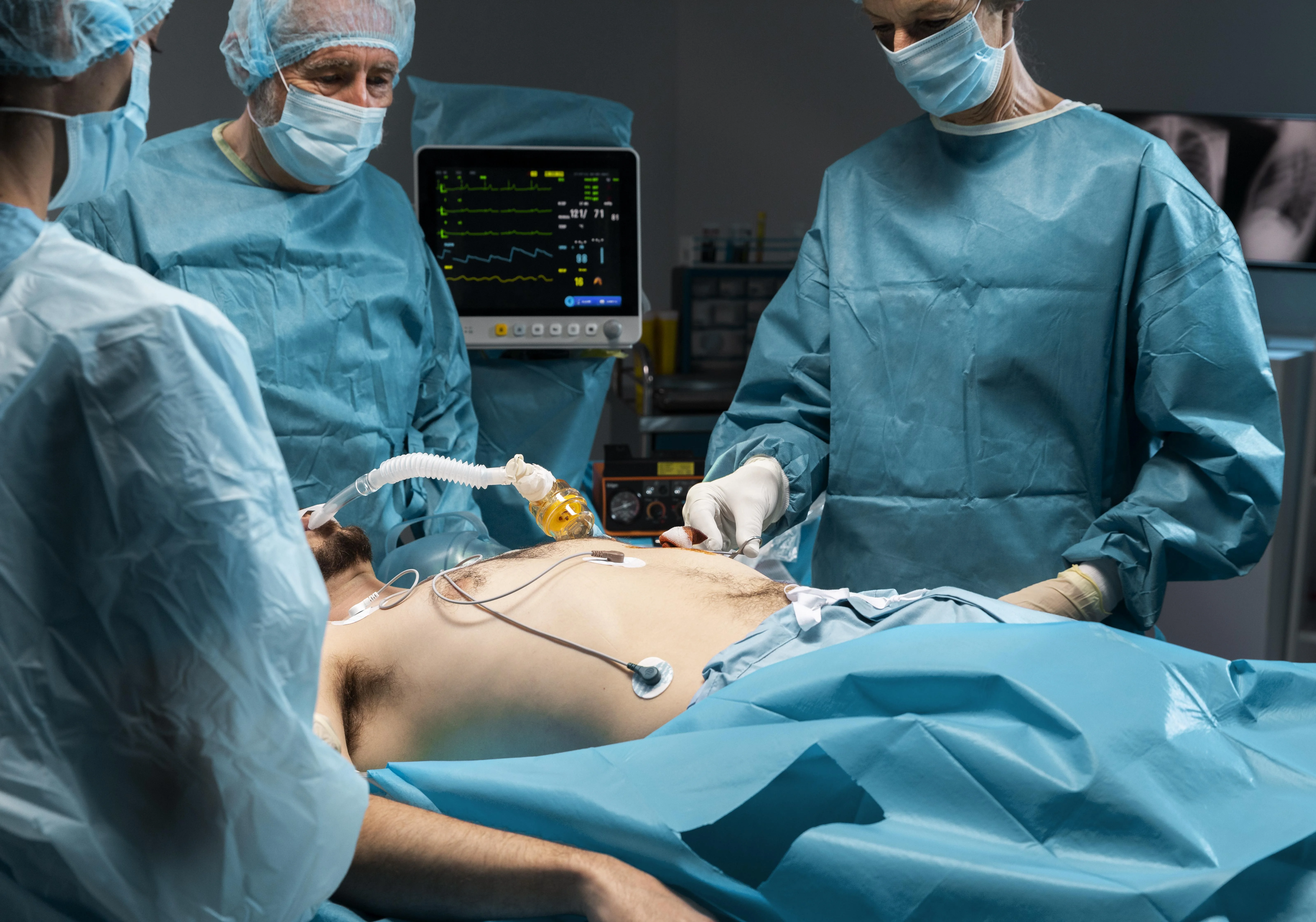 Heart Bypass Surgery (CABG)